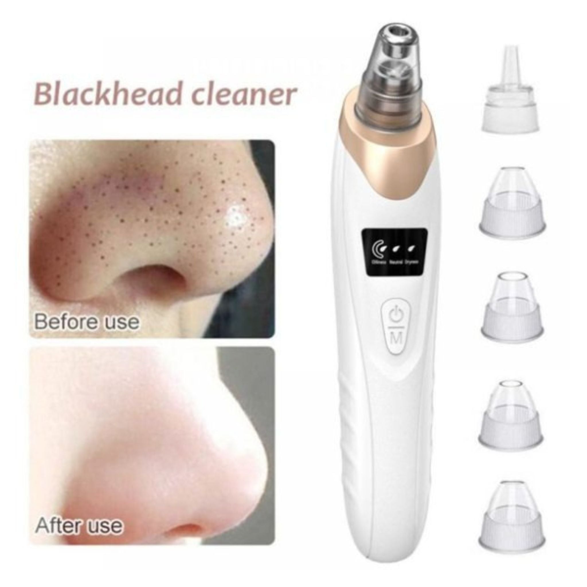 Derma Suction Blackhead Remover Vacuum – Deep Pore Cleansing, Acne & Blackhead Extractor for Clear, Smooth Skin