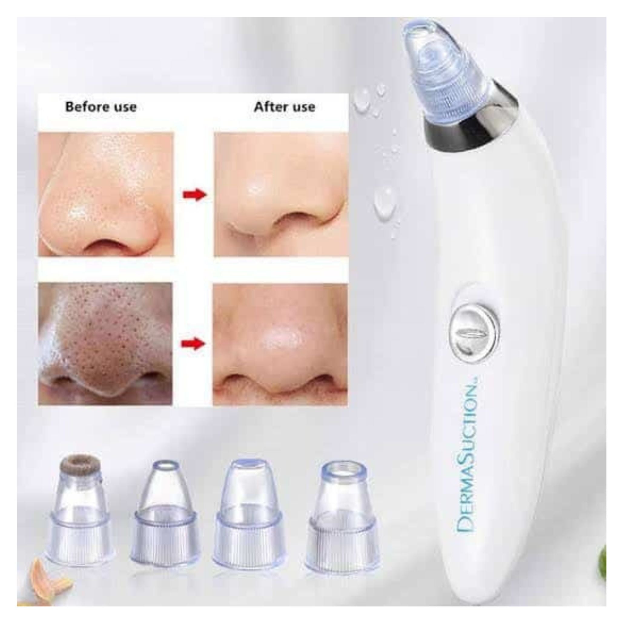 Derma Suction Blackhead Remover Vacuum – Deep Pore Cleansing, Acne & Blackhead Extractor for Clear, Smooth Skin